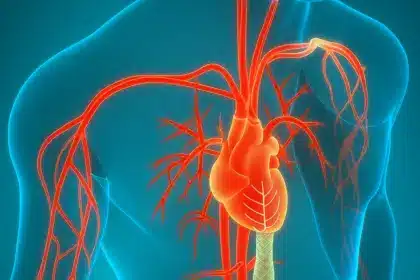 Fortschritte bei Aortenaneurysmen Behandlung